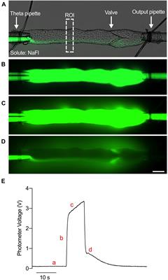 VE-Cadherin and Vesicles Differentially Regulate Lymphatic Vascular Permeability to Solutes of Various Sizes